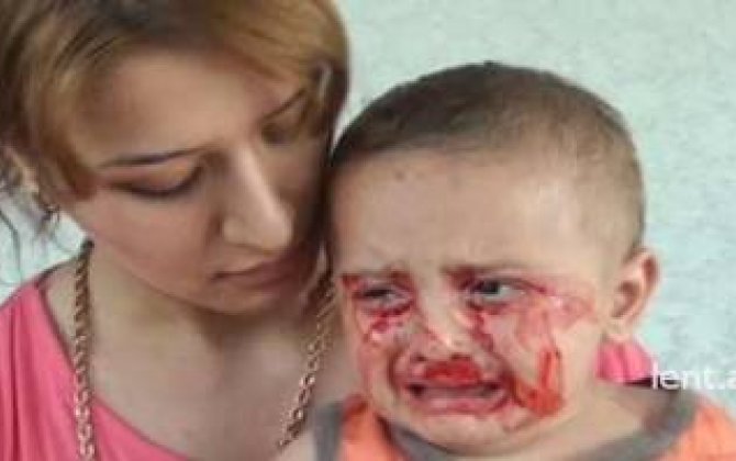 Göyçayda qan ağlayan uşaq  -Video
