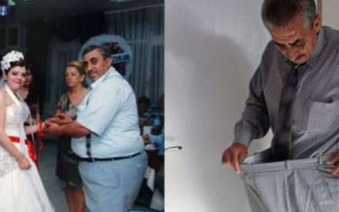Arvadından qorxub 63 kilo verdi 