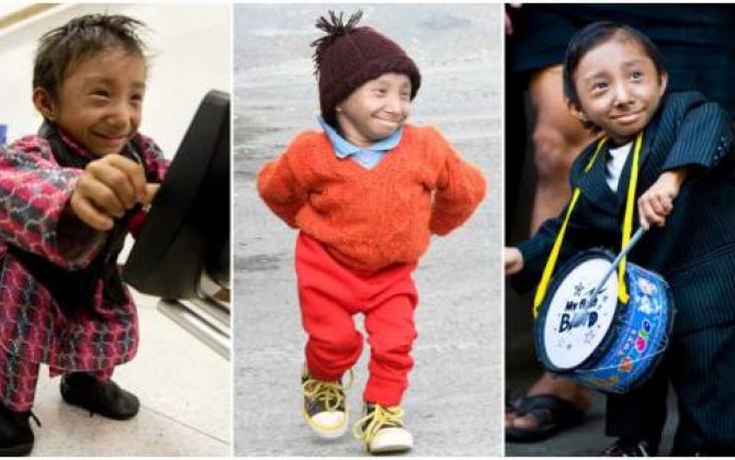 Dünyanın ən kiçik adamı vəfat edib -  FOTO/VİDEO