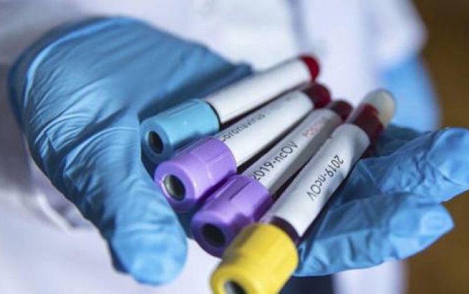 İranda iki nəfərdə koronavirus aşkarlandı 