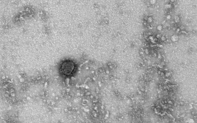 Koronavirusun ilk görüntüləri dərc olundu -  FOTO