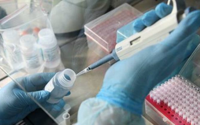 Bakıda naməlum kişi küçədə yıxıldı: Koronavirus şübhəsi -  RƏSMİ AÇIQLAMA