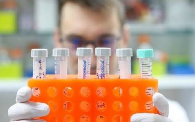 Rusiyada koronavirusu dəqiq müəyyən edən test hazırlandı 