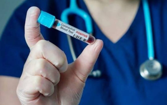Azərbaycanda daha 61 nəfərdə koronavirus aşkarlandı -  RƏSMİ