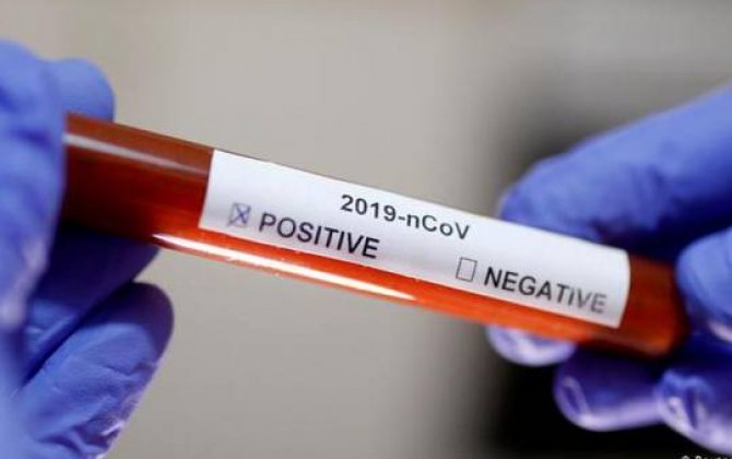 Koronavirus testi verən 11 dövlət başçısı -  Onlardan 2-si virusa YOLUXUB