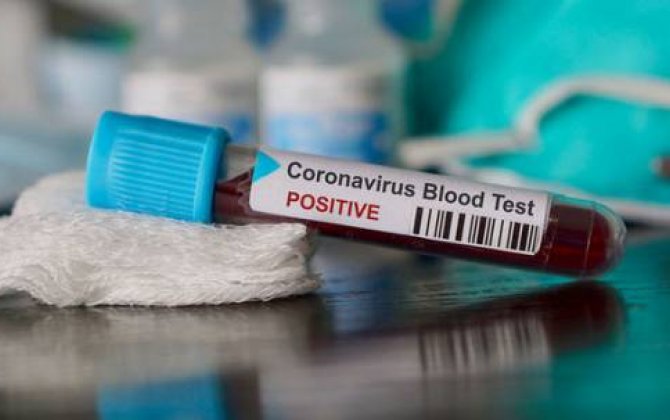 Azərbaycanda daha 12 nəfər koronavirusdan sağaldı -  RƏSMİ