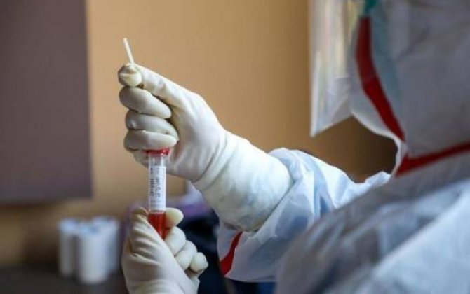Azərbaycanda koronavirusdan daha bir nəfər öldü:  76 yeni yoluxma - RƏSMİ