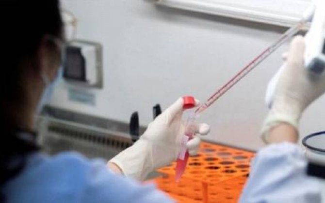 “Koronavirusla mübarizə üçün yeni bir dərman üzərində işləyirik, potenisal var...” -ABŞ dərman şirkəti...