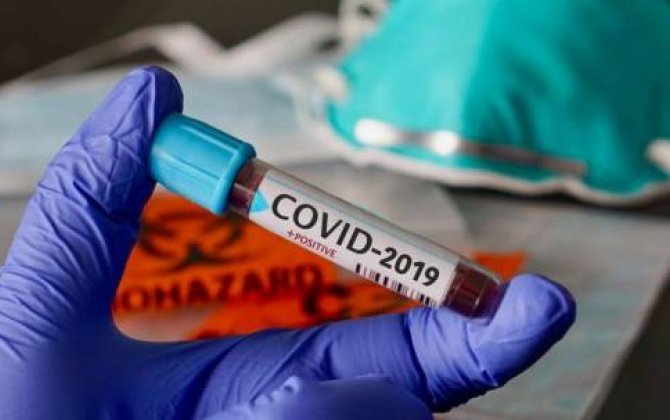 Azərbaycanlı alim koronavirusun tamamən yoxa çıxacağı dəqiq vaxtı açıqladı 