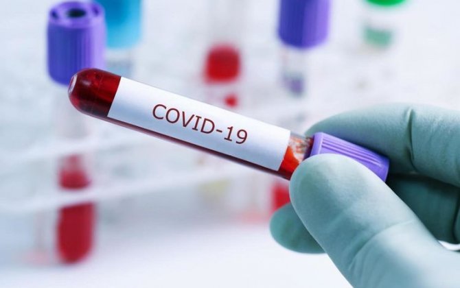 В Иране за прошедшие сутки от коронавируса умерли 74 человека