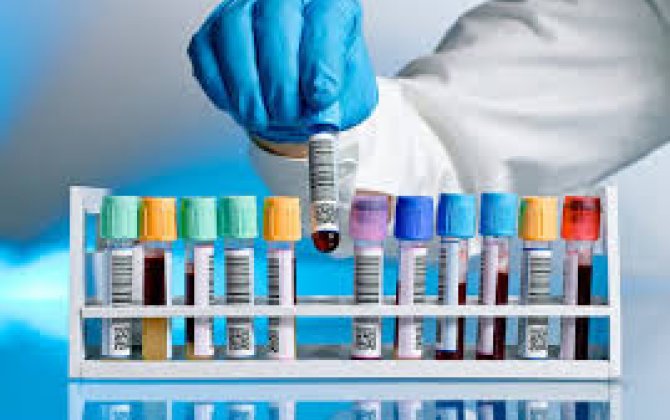 В Азербайджане проведено свыше 180 тыс. тестов на коронавирус
