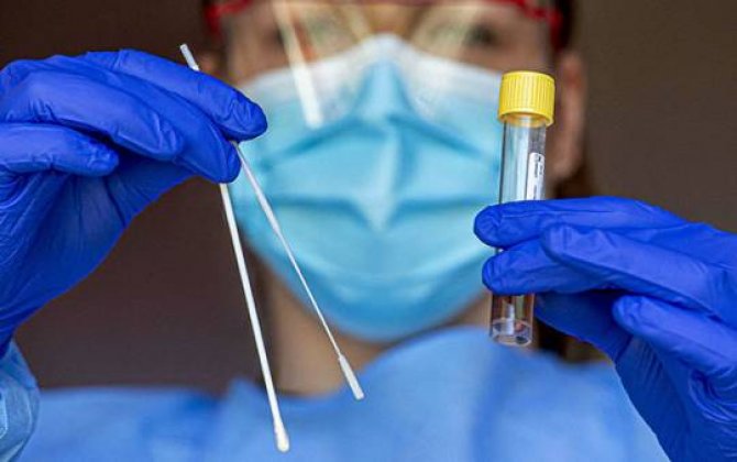 Azərbaycanda daha 149 nəfər koronavirusa yoluxub,  134 nəfər sağalıb, iki nəfər vəfat edib