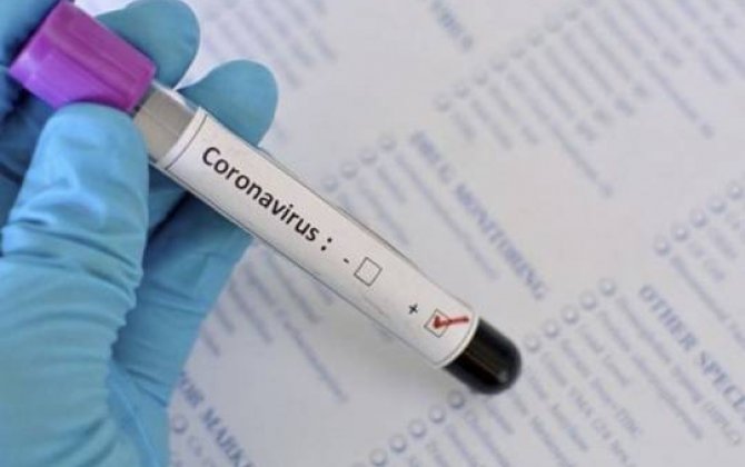 Rusiyada koronavirusa yoluxanların sayı 350 mini ötüb
