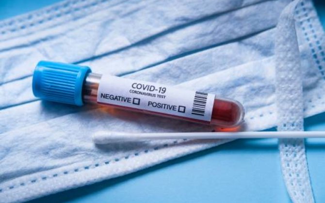 Azərbaycanda daha 248 nəfər koronavirusa yoluxub,  2 nəfər ölüb