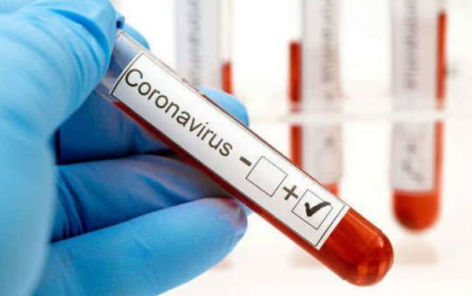 Koronavirusla bağlı  SON STATİSTİKA