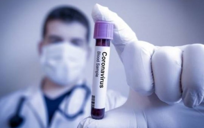 Həkim-infeksionist:  “Qaydalara riayət etməsək, hər birimiz koronavirusa yoluxacağıq”
