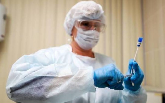 Azərbaycanda daha beş nəfər koronavirusdan öldü:  325 yeni yoluxma faktı qeydə alınıb - RƏSMİ