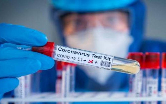 Azərbaycanda indiyədək aparılmış koronavirus testinin sayı açıqlandı