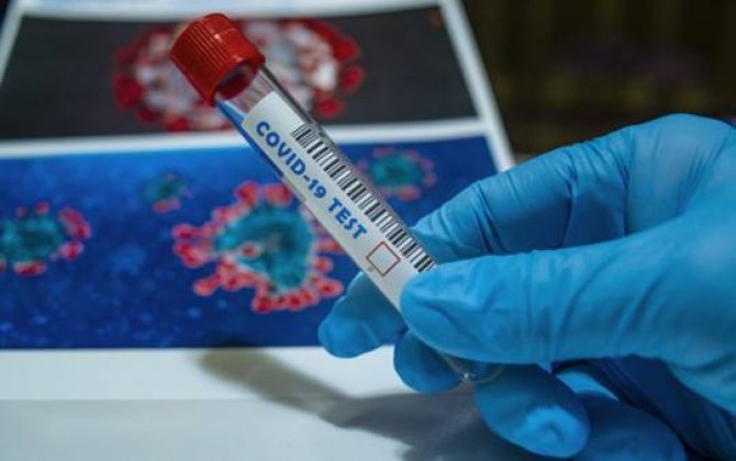 Azərbaycanda daha 478 nəfərdə koronavirus aşkarlandı -  7 nəfər vəfat etdi