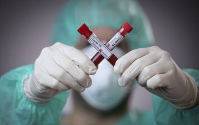 Cənubi Koreyada son sutkada cəmi 62 nəfərdə koronavirus aşkarlanıb 