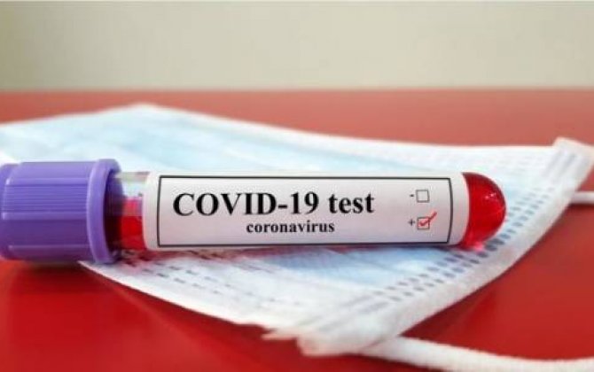 Koronavirusla bağlı son  STATİSTİKA