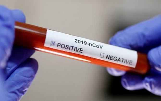 Rusiyada koronavirusun dərmanı patentləşdirildi