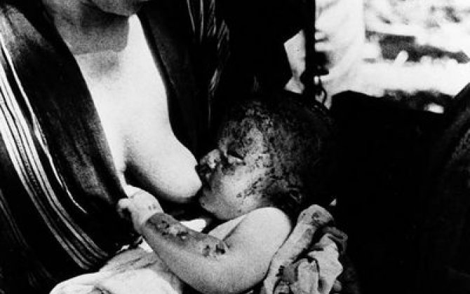 Bu gün Xirosimaya atom bombası atılmasından 75 il keçir -  FOTO