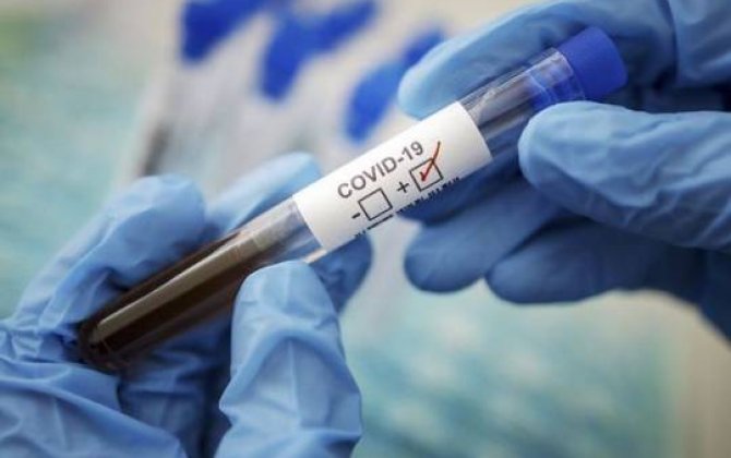 Dünyada koronavirusdan sağalanların sayı 13 milyonu keçdi -  STATİSTİKA