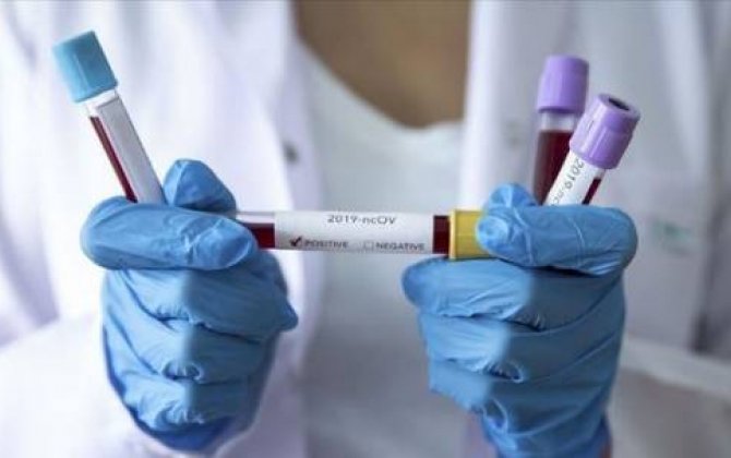 Azərbaycanda daha 32 nəfər koronavirusdan öldü:  4212 yeni yoluxma - FOTO