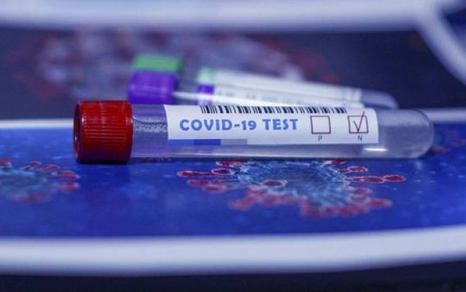 İranda ötən sutkada koronavirusdan 391 nəfər ölüb 