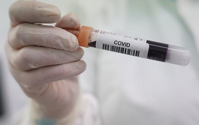 В ВОЗ назвали период заразности переболевших коронавирусом