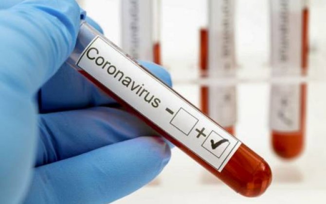 Rusiyada son sutka ərzində koronavirusdan 612 nəfər ölüb 