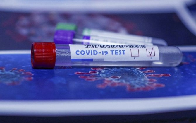 Azərbaycanda daha 733 nəfər koronavirusa yoluxub, 8 nəfər vəfat edib