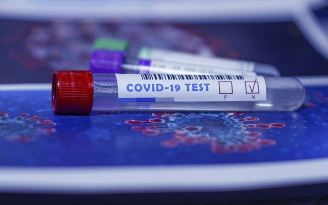 Azərbaycanda indiyədək 3096740 koronavirus testi aparılıb