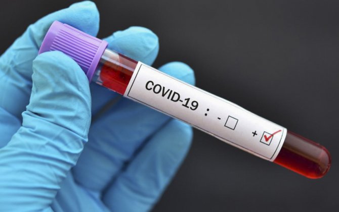 России за последние сутки коронавирусом заразились 17 378 человек