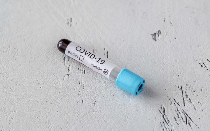 Azərbaycanda daha 55 nəfər koronavirusa yoluxub, ölən yoxdur