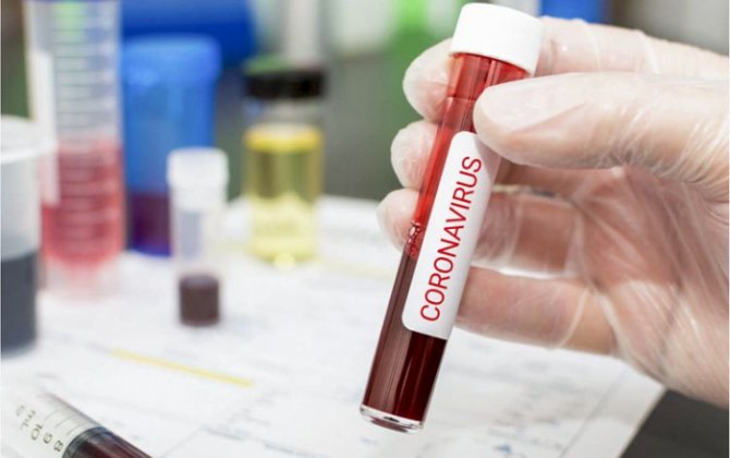 Koronavirusa son sutkada yoluxanların sayı açıqlandı
