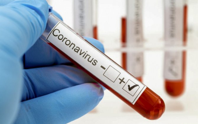 В России за последние сутки коронавирусом заразились 20 765 человек, умерли 806 человек