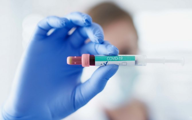 Azərbaycanda daha 2372 koronavirusa yoluxub, 34 nəfər vəfat edib