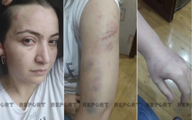 Arvadını öldürən polisin övladlarının kimin qəyyumluğuna veriləcəyi məlum olub