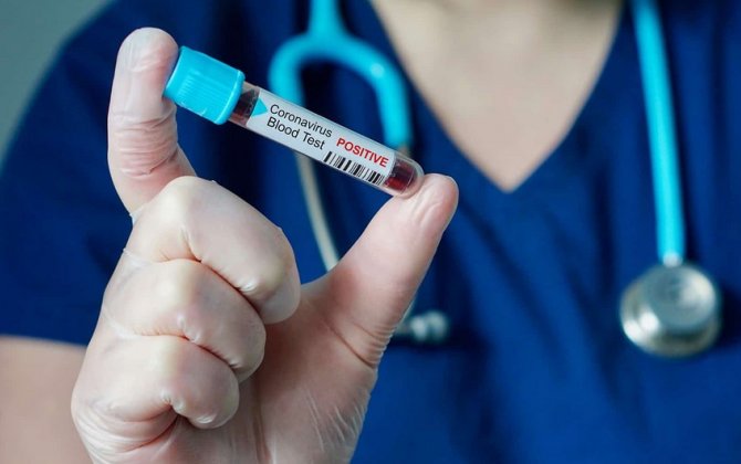 Azərbaycanda daha 2102 nəfər koronavirusa yoluxub, 15 nəfər ölüb
