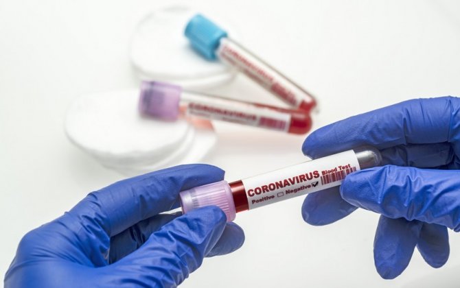 Azərbaycanda daha 2124 nəfər koronavirusa yoluxub, 27 nəfər ölüb
