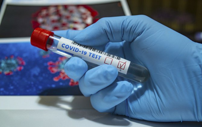 В Грузии от коронавируса умерли еще 37 человек