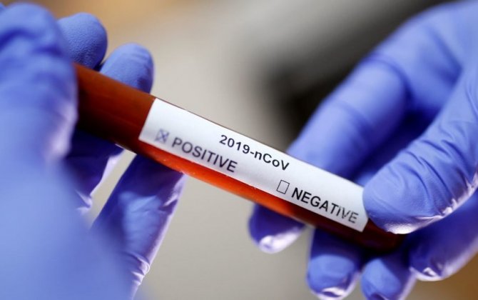 Azərbaycanda daha 1614 nəfər koronavirusa yoluxub, 16 nəfər ölüb
