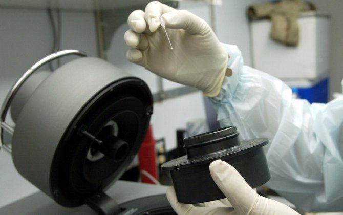 Portuqaliyada “Meymun çiçəyi”nə 20-dən çox yoluxma aşkarlanıb