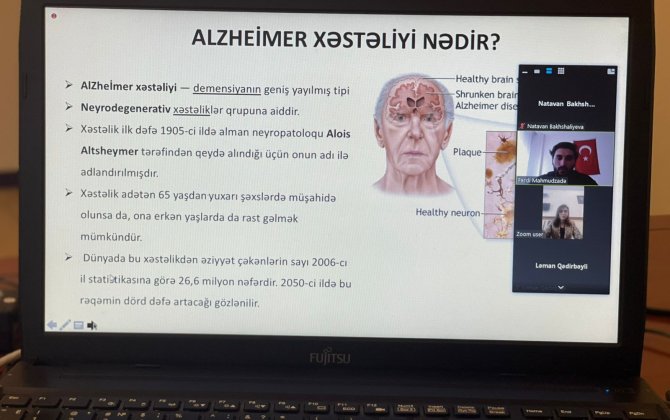 BDU-da Alzheimer xəstəliyinin kök hüceyrə ilə müalicəsinə dair seminar