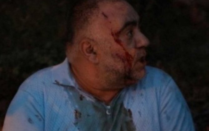 Во время протестов в Армении пострадали десятки человек - ФОТО/ВИДЕО