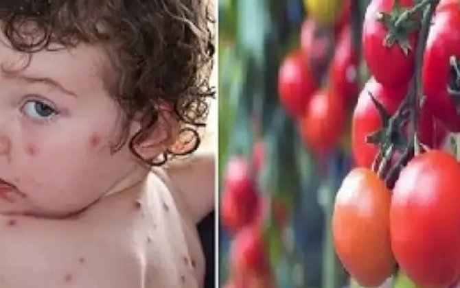 Dünyada yeni virus yayılır – “Pomidor qripi”