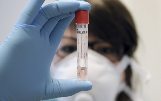 Azərbaycanda son sutkada 67 nəfər koronavirusa yoluxub