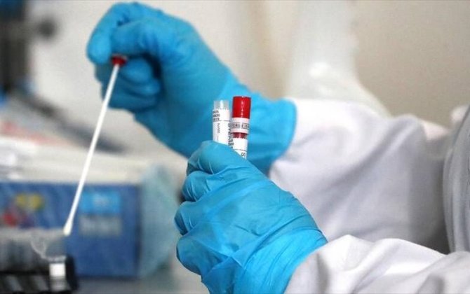 Azərbaycanda daha 33 nəfər COVID-19-a yoluxub, 1 nəfər vəfat edib - FOTO